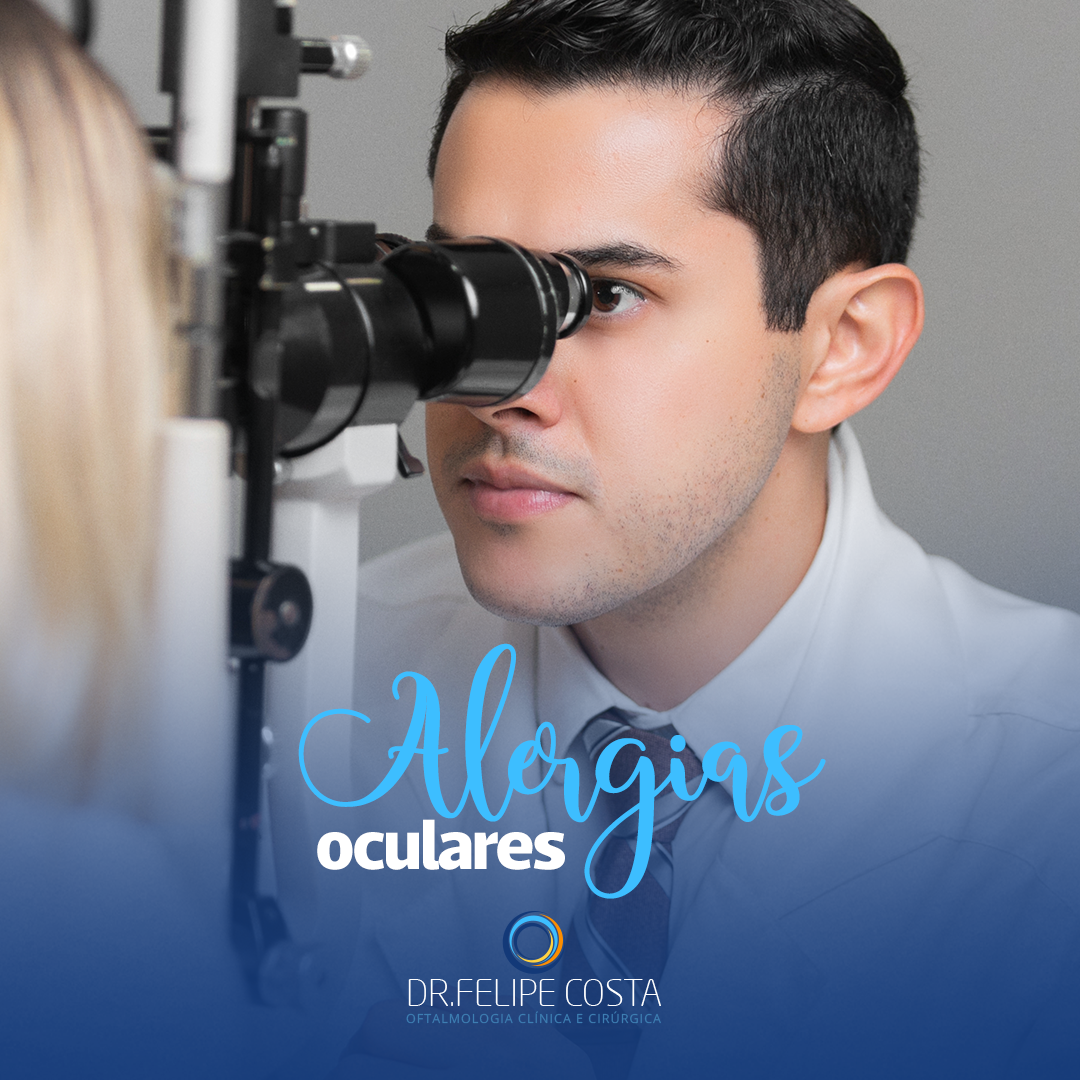 ALERGIAS OCULARES