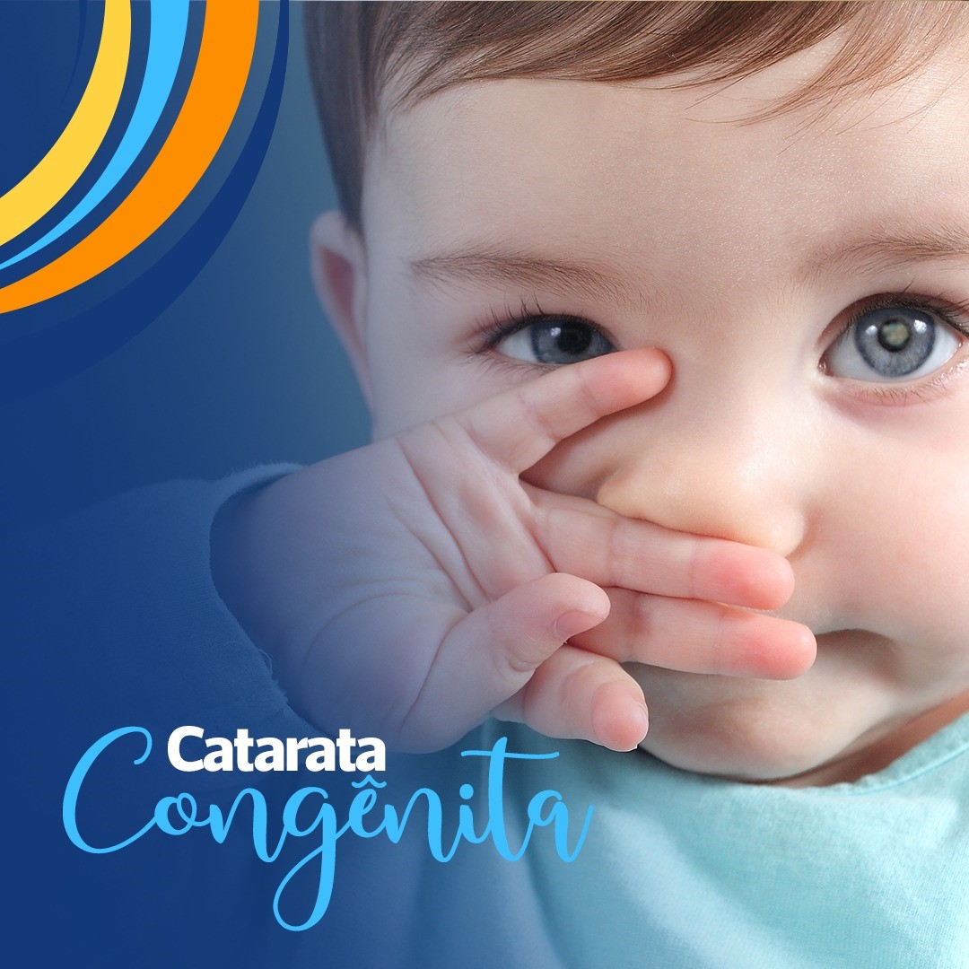 Catarata Congênita